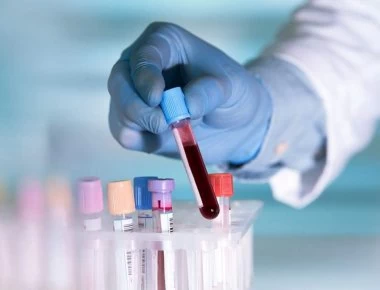 Ερευνητές βρήκαν μέθοδο για να εντοπίζουν με τεστ αίματος τη νόσο Αλτσχάιμερ πριν εμφανιστούν τα συμπτώματα